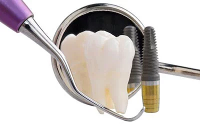 set of dental tools with dental implant