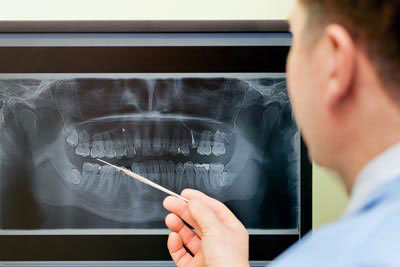 dentist using a 3D Digital X-Rays at our dental office
