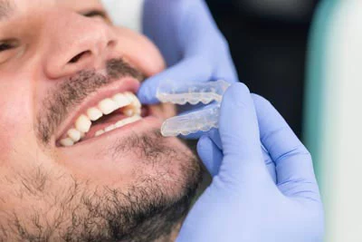 Dr. Thode placing Invisalign clear braces in a patient's mouth