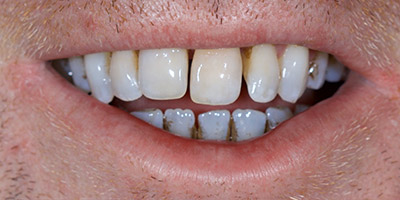 Before image