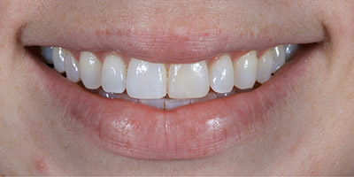 After image