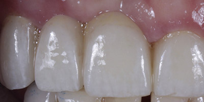 After image
