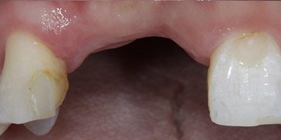 Before image