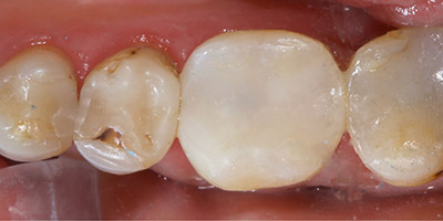 After image