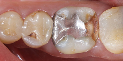 Before image