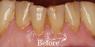 Before image