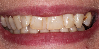 Before image