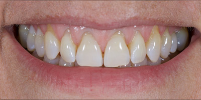 Before image