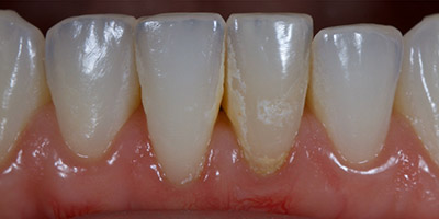 After image