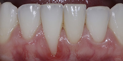 Before image