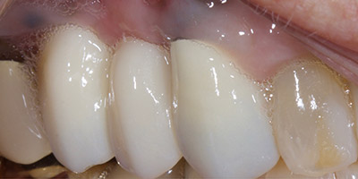 After image