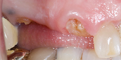 Before image