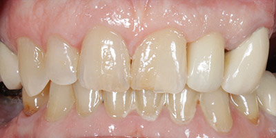 After image