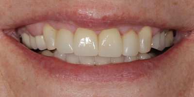 After image