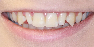 Before image