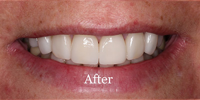 After image