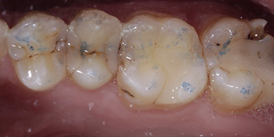 Before image