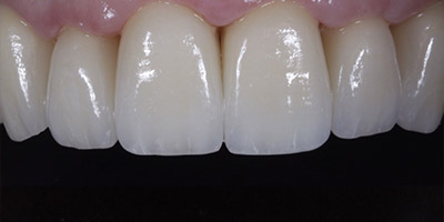 After image