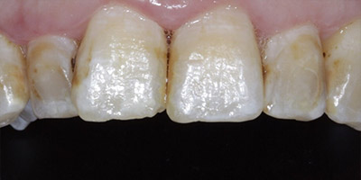 Before image