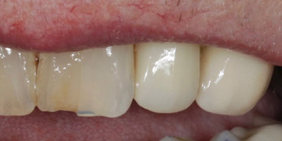 After image