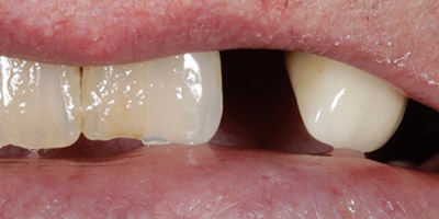 Before image