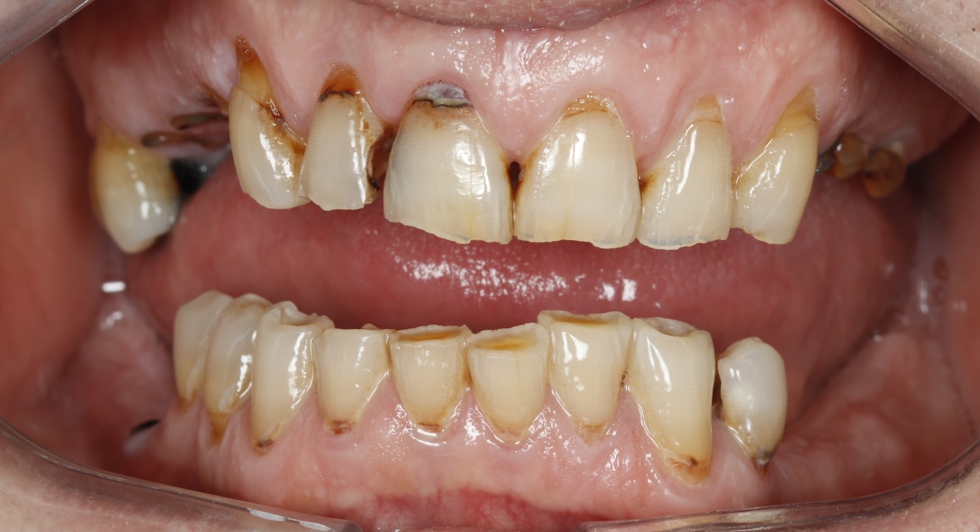 Before image