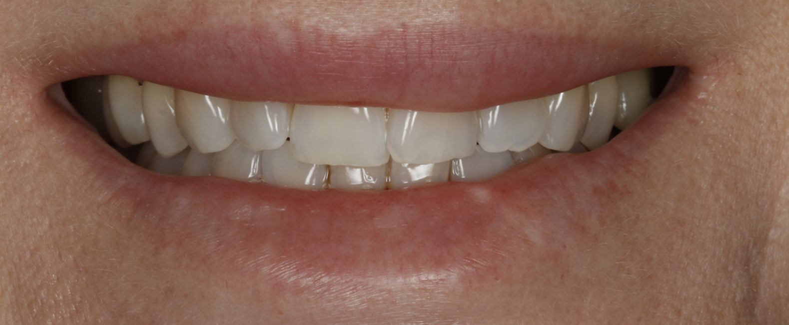 Before image